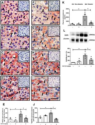 Effect of the renin-angiotensin system on the exacerbation of adrenal glucocorticoid steroidogenesis in diabetic mice: Role of angiotensin-II type 2 receptor